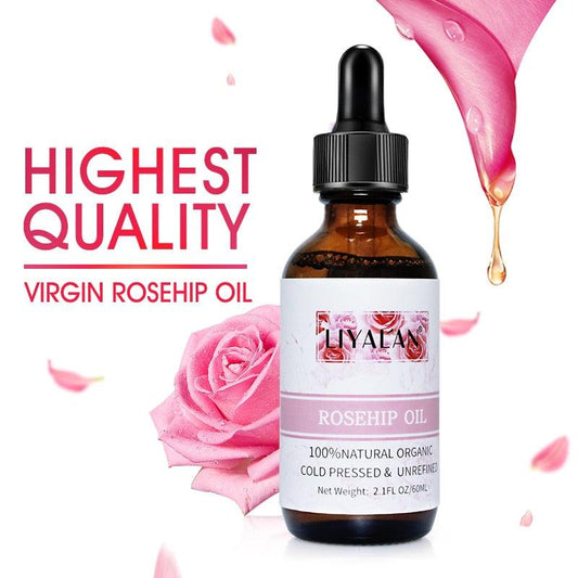 Cold Pressed Virgin Rosehip Essential Oil - JuViLu Essentials