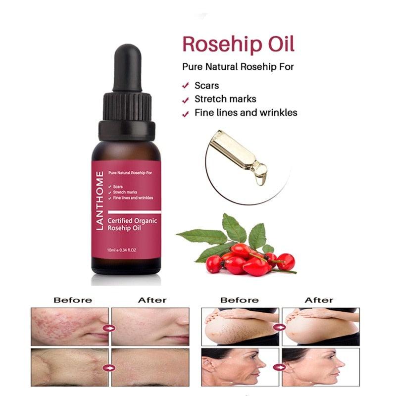 Rosehip Oil 10ml - JuViLu Essentials